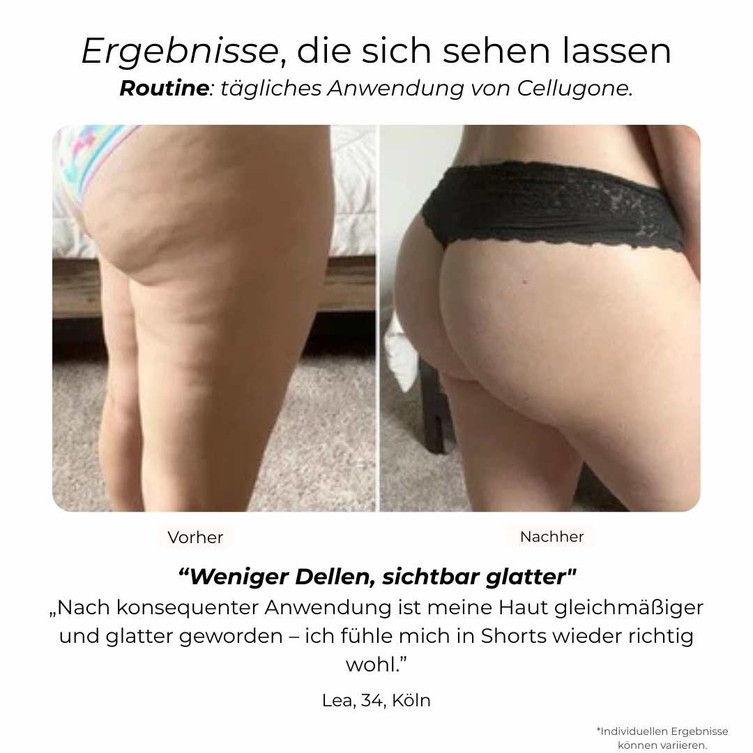 Sichtbar Straffere Haut an Bauch & Beinen mit Cellugone 3.0