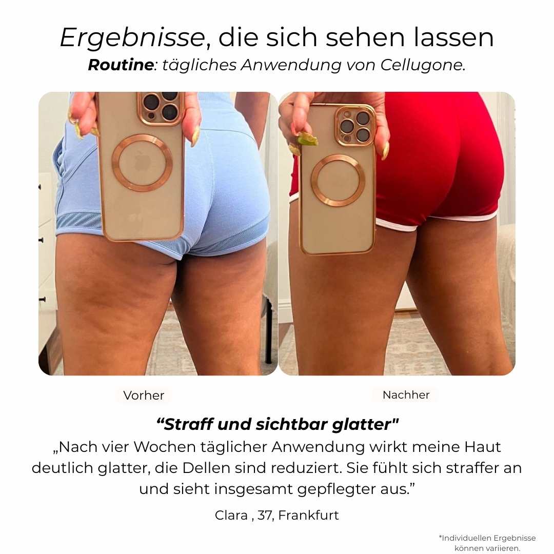 Sichtbar Straffere Haut an Bauch & Beinen mit Cellugone 3.0