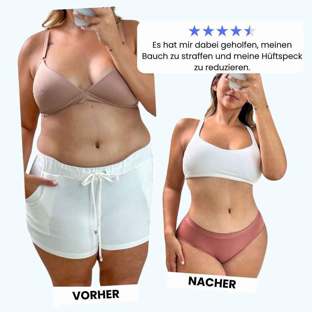 Sichtbar Straffere Haut an Bauch & Beinen mit Cellugone 3.0